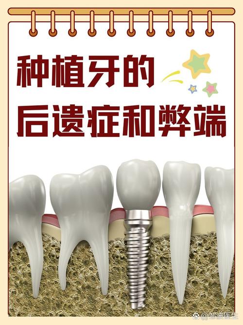 种植牙有什么坏处
