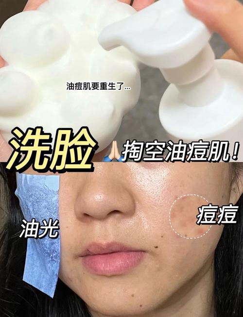 换洗面奶长痘痘怎么回事