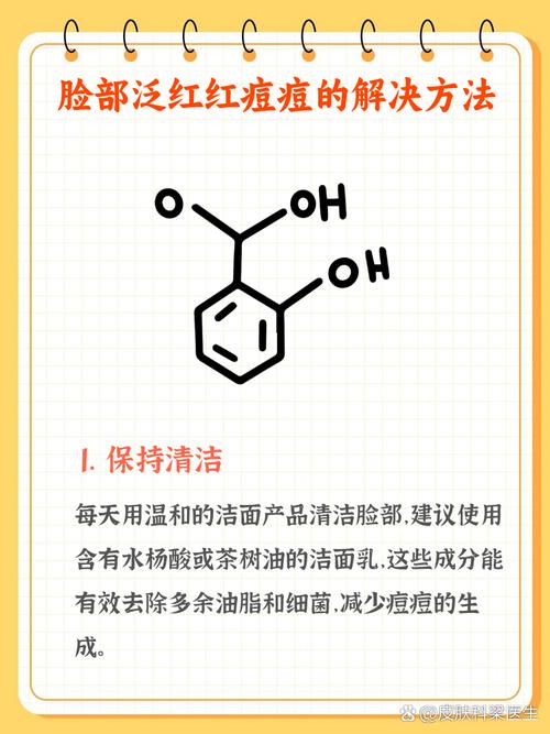 换洗面奶长痘痘怎么回事