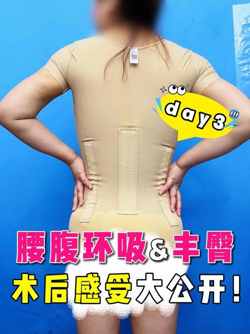 什么是环吸