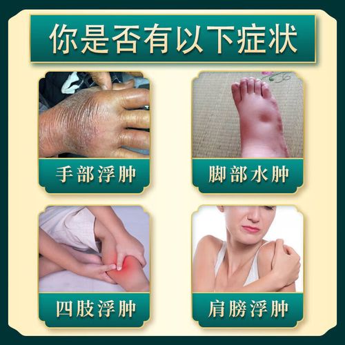 脸肿了吃什么