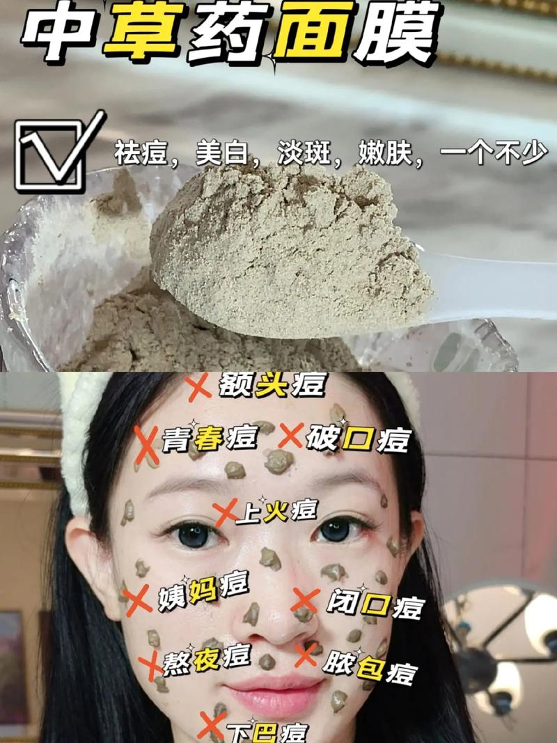敷什么祛痘