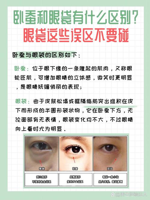 什么是卧蚕什么是眼袋