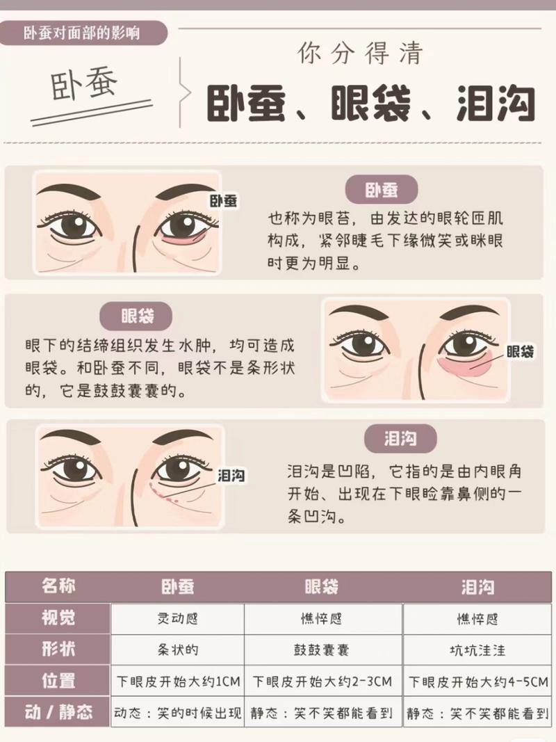 什么是眼袋什么是卧蚕