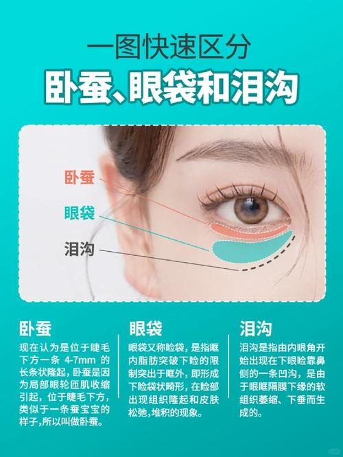 什么是眼袋什么是卧蚕