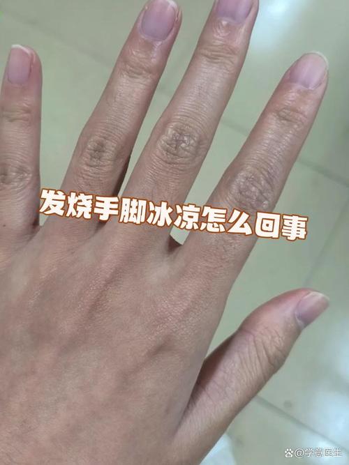 冬天手凉是什么原因