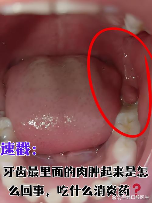 最后面的牙齿叫什么