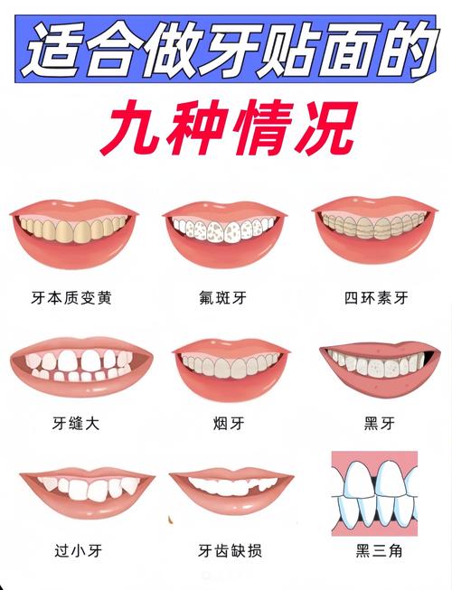 最后面的牙齿叫什么