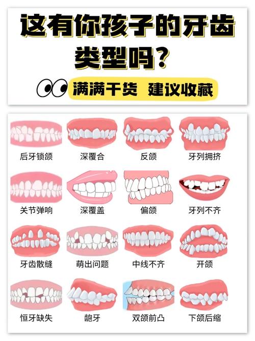 什么样的牙需要矫正