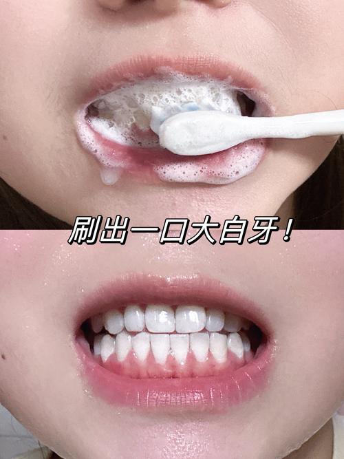 用什么刷牙可以变白