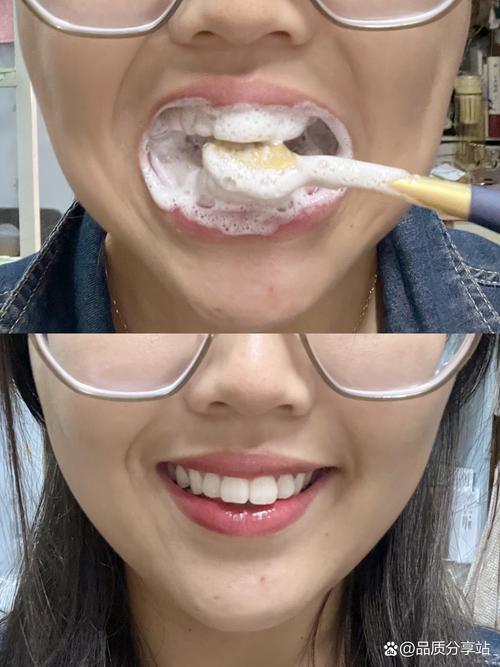 用什么刷牙可以变白
