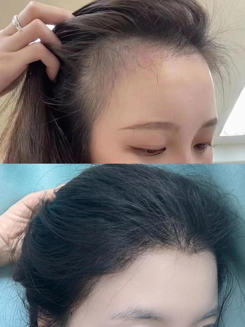 种头发是什么