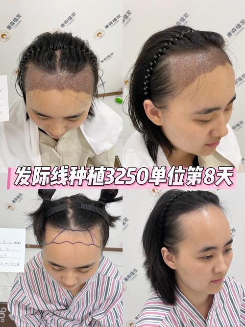 种头发是什么