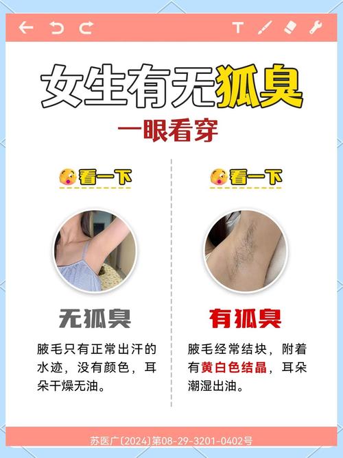 狐臭是什么科