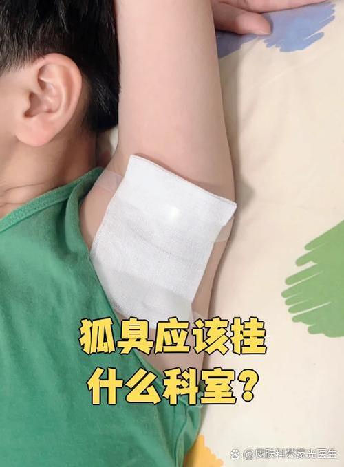 狐臭是什么科