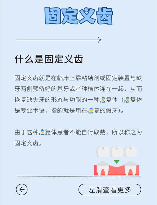 什么是固定假牙
