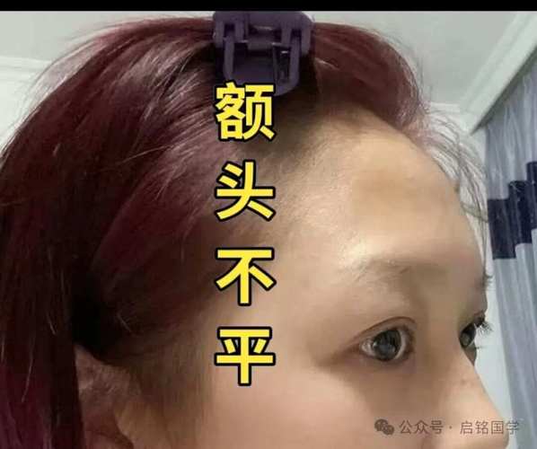 什么是额头低