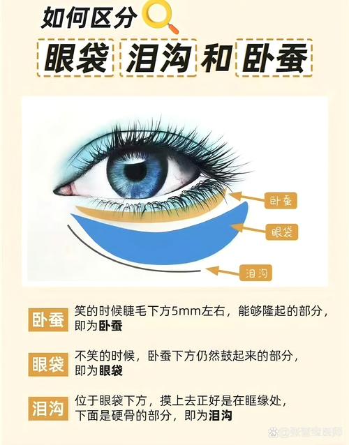 什么是眼袋什么是泪沟