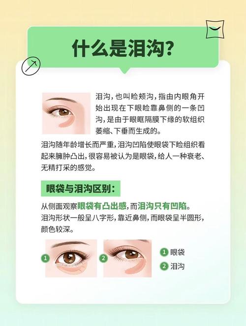 什么是眼袋什么是泪沟