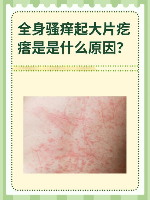 四肢发痒是什么原因