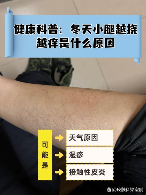 四肢发痒是什么原因