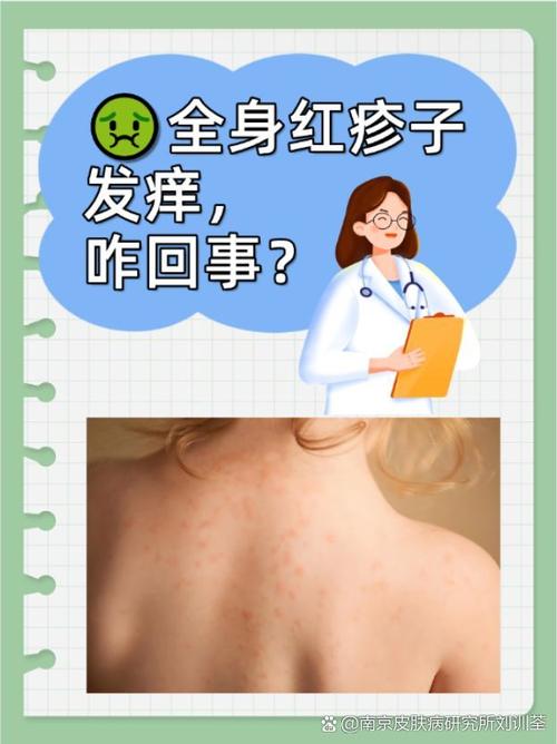 四肢发痒是什么原因