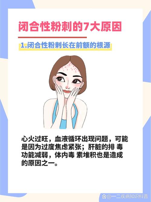 长闭合粉刺是什么原因