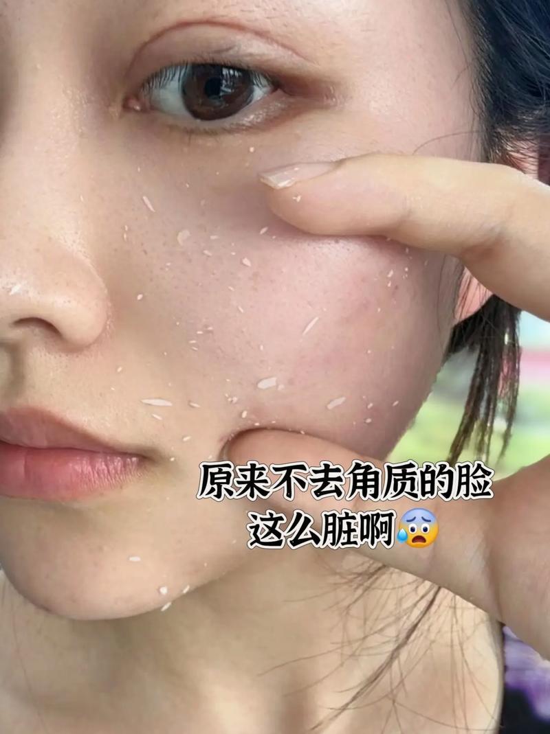 角质层是什么东西