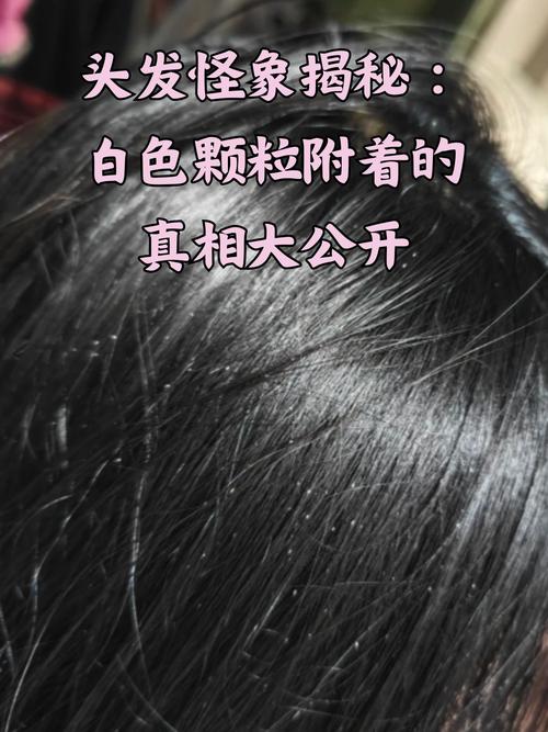 头发上白白的是什么
