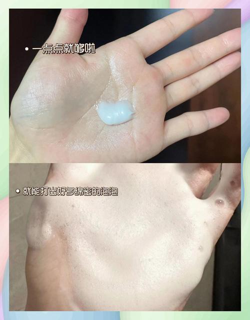 为什么洗完洗面奶长痘痘怎么回事啊