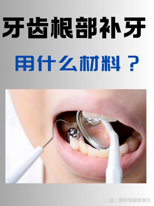 蛀牙补牙挂什么科