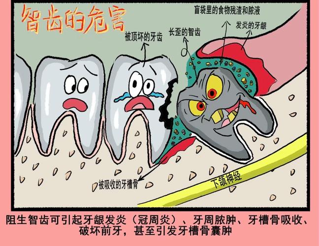 为什么智齿容易坏