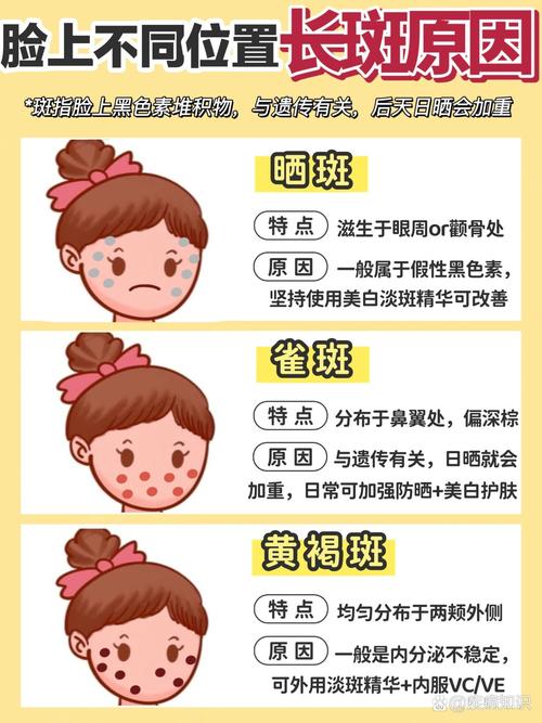 脸上为什么有雀斑