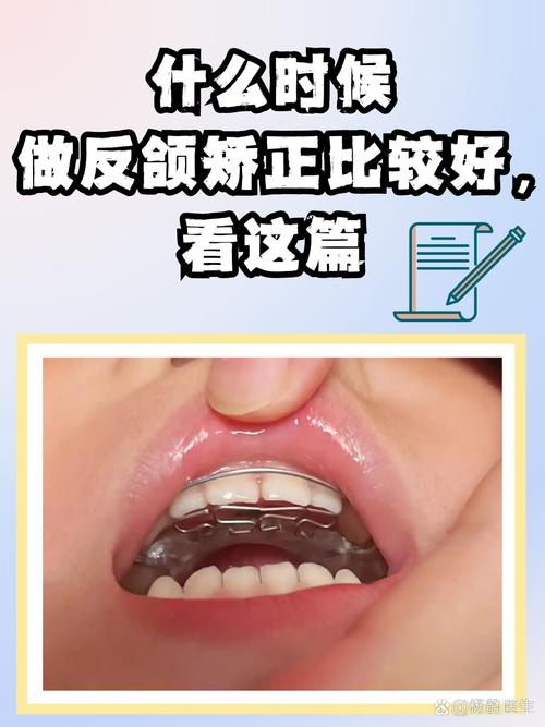 对颌是什么