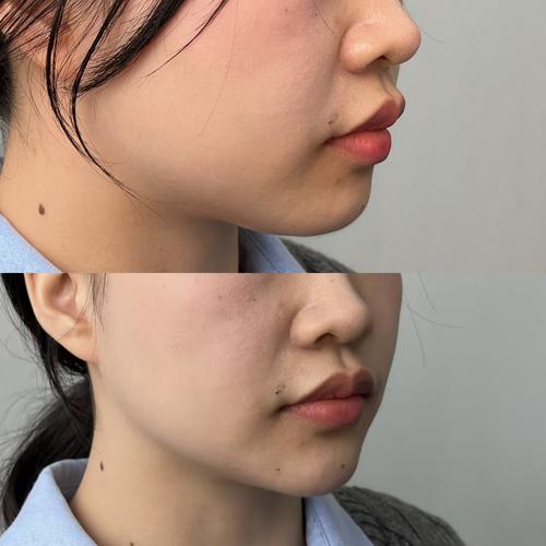 下巴什么形状好看