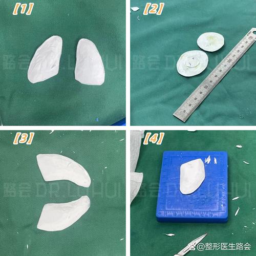什么是鼻雕