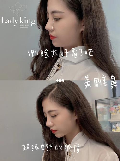 什么是鼻雕