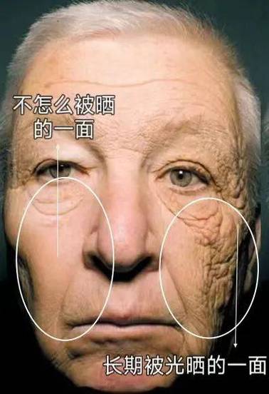什么是光老化