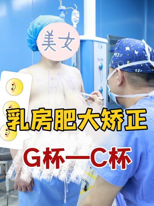 缩乳是什么