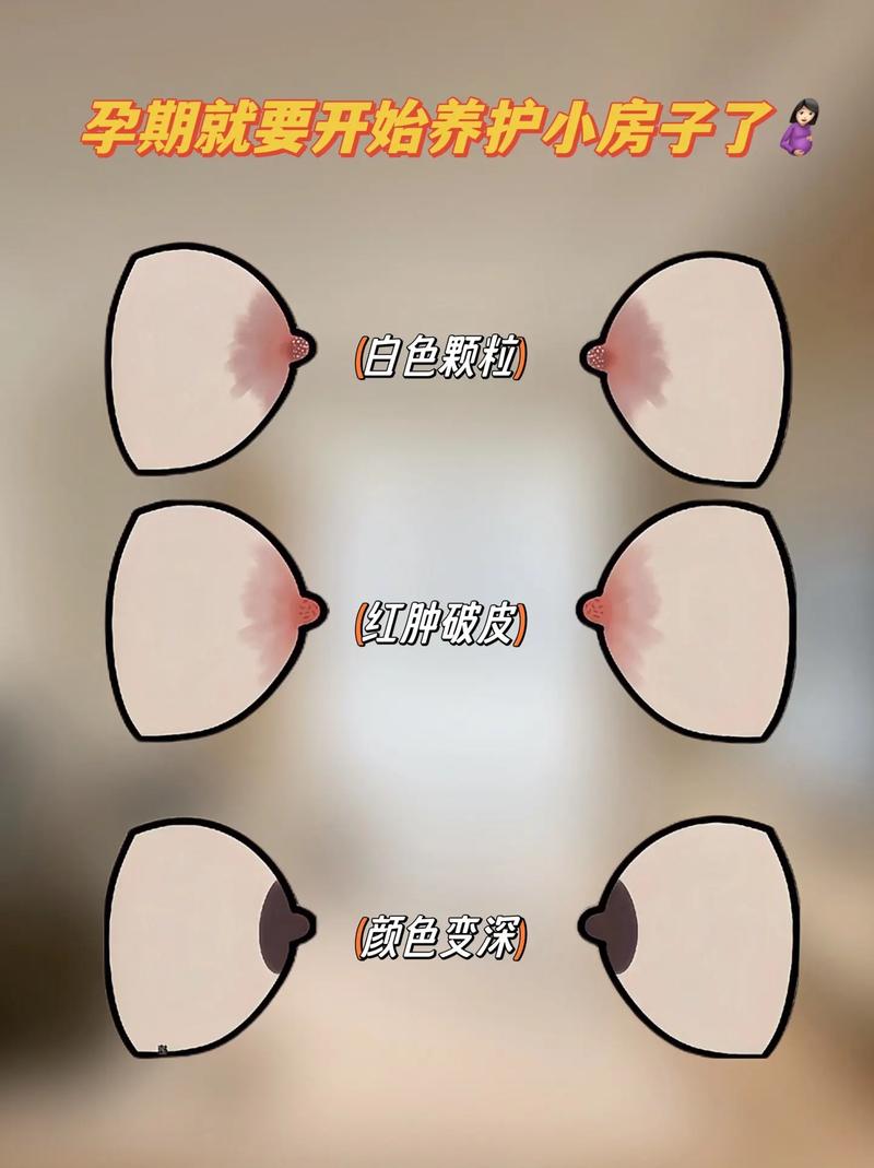 乳晕代表什么