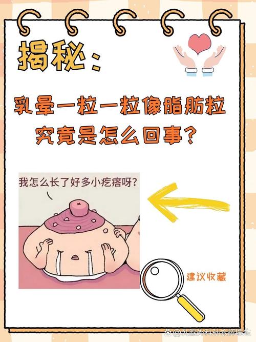 乳晕代表什么