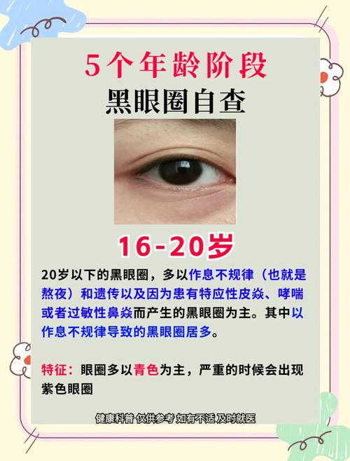眼周发黑是什么原因