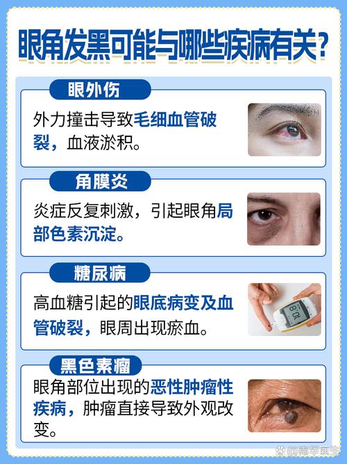 眼周发黑是什么原因