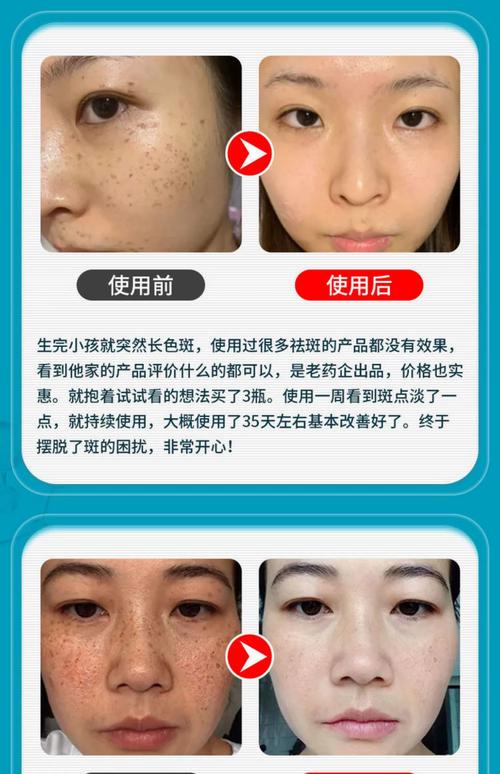 用什么洗脸可以祛斑