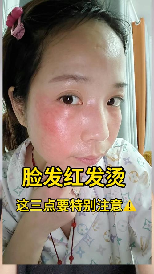脸部发烫是什么原因