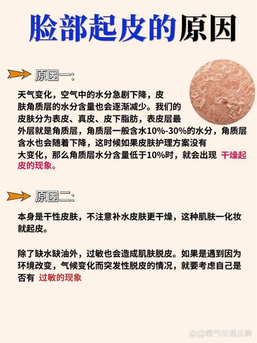 脸蜕皮是什么原因