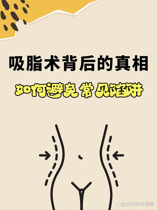 吸脂手术有什么危害