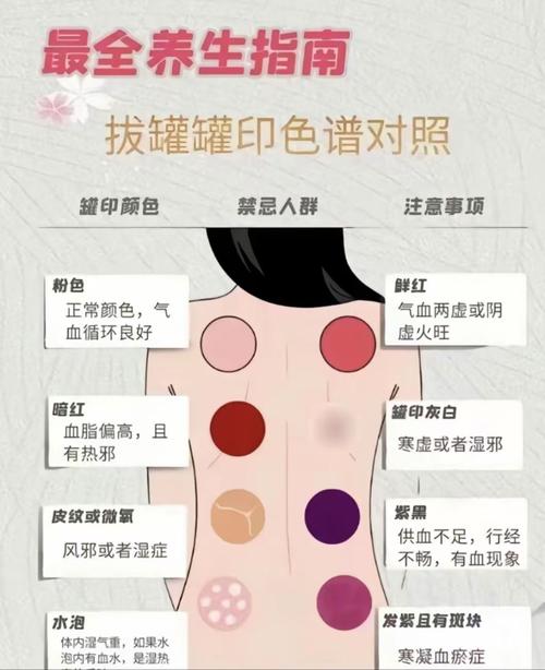 拔罐减肥是什么原理