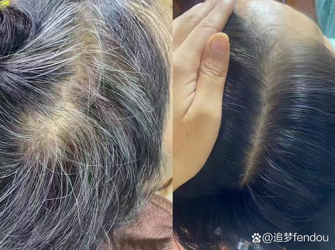 人为什么会长白发