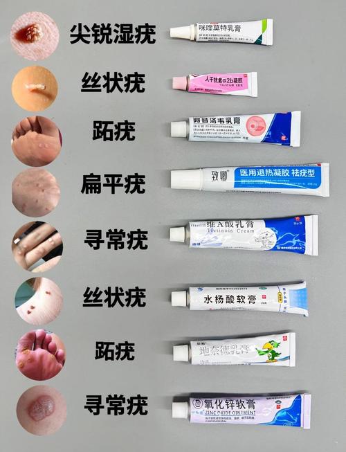 扁平疣做什么检查